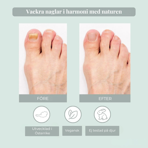 Nailiva™ Nagelvårdspenna