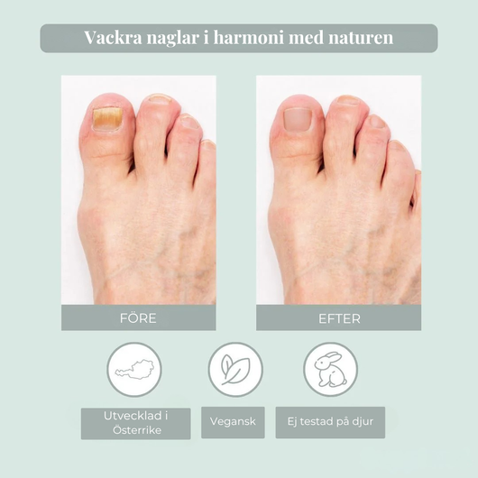 Nailiva™ Nagelvårdspenna